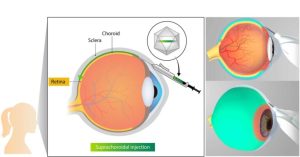 Kriya Therapeutics Presents Preclinical Data for KRIYA-825 Gene Therapy in Geographic Atrophy 1 ophthalmology graphic 02 1 768x403 1