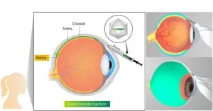 ophthalmology graphic 02 1 768x403 1